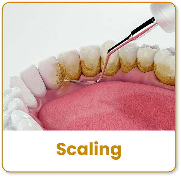 scaling