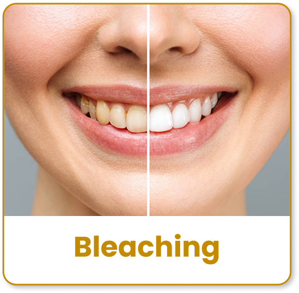 bleaching