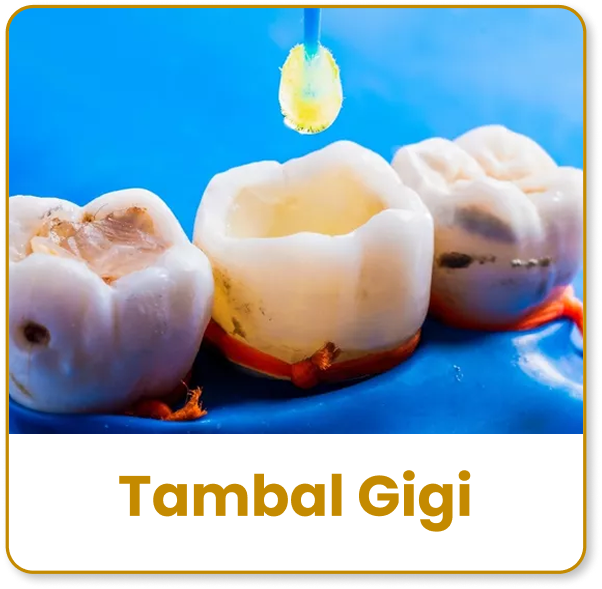 tambal