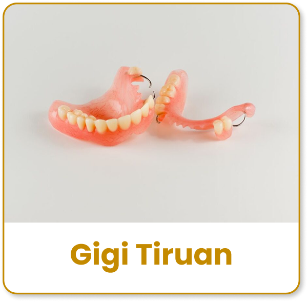gigi tiruan
