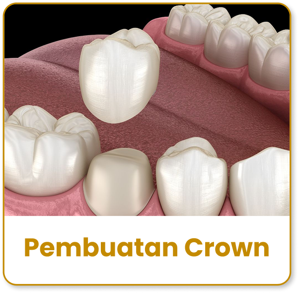crown
